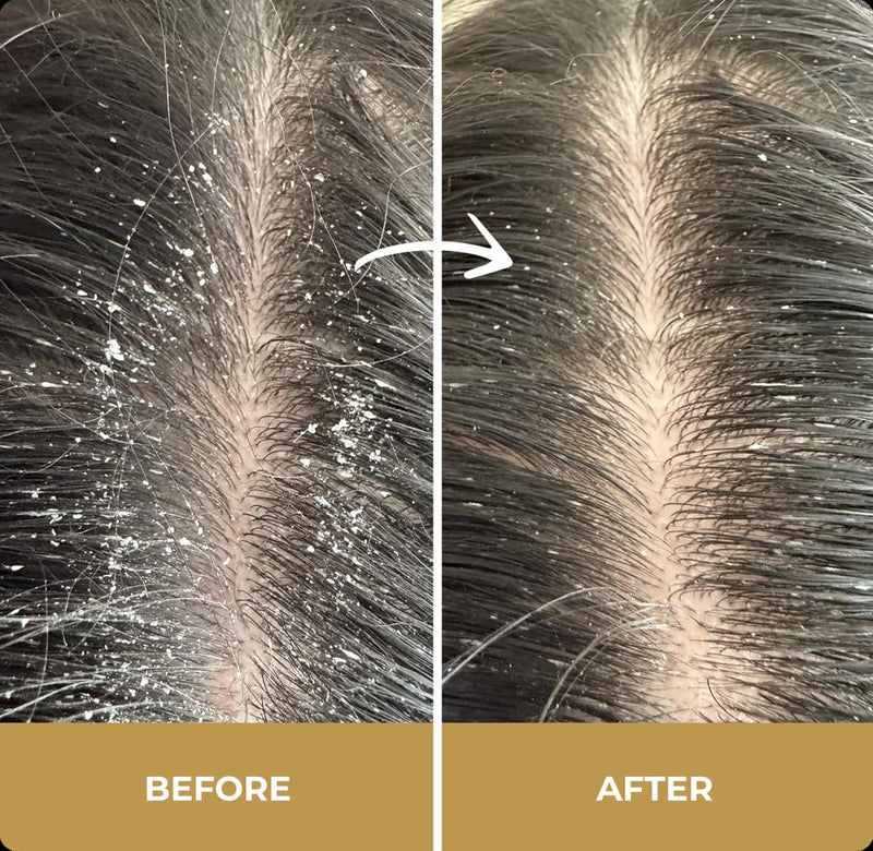Before vs After Step Zero