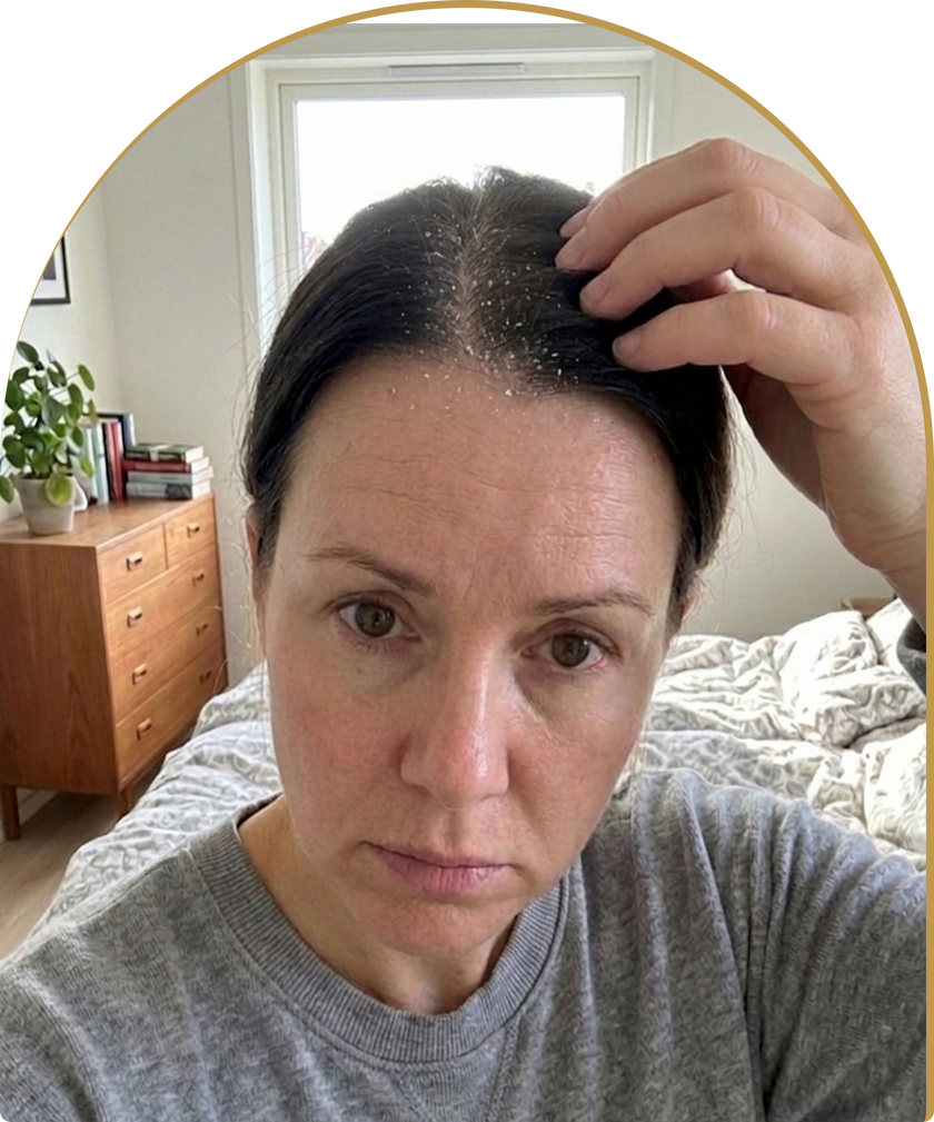 Your Scalp Isn't Actually Clean